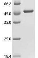 Human Guanine nucleotide-binding protein G (q) subunit alpha (GNAQ) Recombinant Protein - BioCrest Sci