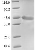Human Protein FAM46C (FAM46C) Recombinant Protein, N-His - BioCrest Sci