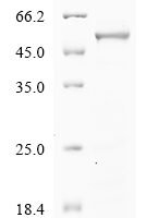 Human Phenylalanine-4-hydroxylase (PAH) Recombinant Protein - BioCrest Sci