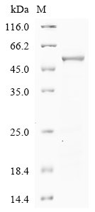 Human Phenylalanine-4-hydroxylase (PAH) Recombinant Protein, Homo sapiens (Human), E.coli, N-terminal 6xHis-tagged, 55.8 kDa, purity >≥ 85% as determined by SDS-PAGE.