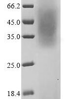 Mouse Beta-enolase (Eno3) Recombinant Protein, N-His - BioCrest Sci