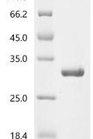 Staphylococcus aureus Chloramphenicol acetyltransferase (cat) Recombinant Protein - BioCrest Sci