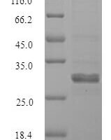 Human Sal-like protein 2 (SALL2), partial Recombinant Protein - BioCrest Sci