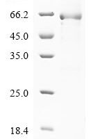 Human Serpin B7 (SERPINB7) Recombinant Protein, N-GST, aa 1–380, E.coli - BioCrest Sci