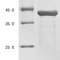 Klebsiella pneumoniae OmpK36 (OmpK36) Recombinant Protein, N-His - BioCrest Sci