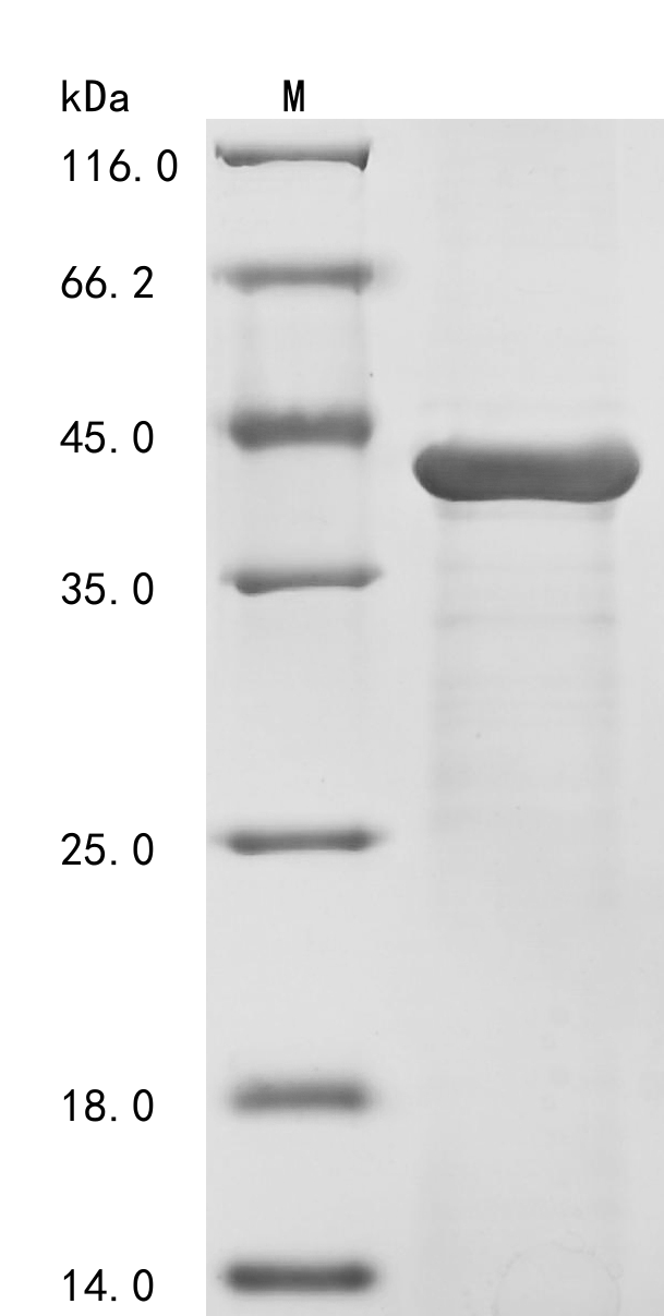 Klebsiella pneumoniae OmpK36 (OmpK36) Recombinant Protein, N-His, Klebsiella pneumoniae, E.coli, N-terminal 6xHis-tagged, 42.8 kDa, purity >≥ 85% as determined by SDS-PAGE.