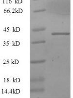 Human Alpha-synuclein (SNCA), partial Recombinant Protein, N-GST - BioCrest Sci