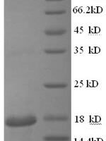 Mouse Hemoglobin subunit beta-2 (Hbb-b2) Recombinant Protein, N-GST - BioCrest Sci