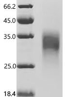 Human Activin receptor type-2B (ACVR2B), partial, Biotinylated Recombinant Protein - BioCrest Sci