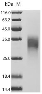 Human Activin receptor type-2B (ACVR2B), partial, Biotinylated Recombinant Protein, Mammalian cell, C-terminal 10xHis-Avi-tagged, 17.2 kDa, purity >≥ 95% as determined by SDS-PAGE.