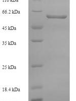Human Pseudokinase FAM20A (FAM20A) Recombinant Protein, N-His - BioCrest Sci