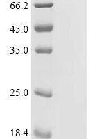 Human Rho GTPase-activating protein 33 (ARHGAP33), partial Recombinant Protein - BioCrest Sci