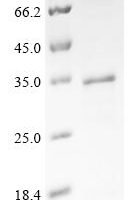 Human A-kinase anchor protein 8 (AKAP8), partial Recombinant Protein - BioCrest Sci