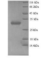 Human Chromobox protein homolog 7 (CBX7) Recombinant Protein, N-His, aa 1–251, Yeast - BioCrest Sci
