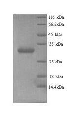 Human Chromobox protein homolog 7 (CBX7) Recombinant Protein, N-His, aa 1–251, Yeast, Homo sapiens (Human), Yeast, N-terminal 6xHis-tagged, 30.3 kDa, purity >≥ 90% as determined by SDS-PAGE.