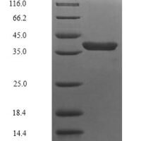 Escherichia coli Transposase insE for insertion sequence IS3A (insE1) Recombinant Protein - BioCrest Sci