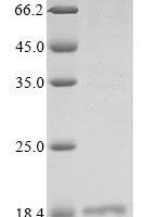 Human Protein lin-28 homolog A (LIN28A), partial Recombinant Protein - BioCrest Sci