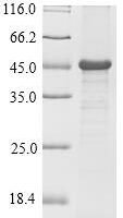 Mouse Troponin I, cardiac muscle (Tnni3) Recombinant Protein, N-His-SUMO - BioCrest Sci
