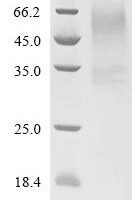 Human Voltage-dependent calcium channel gamma-1 subunit (CACNG1)-Detergent Recombinant Protein - BioCrest Sci