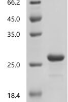 Escherichia coli O157:H7 Hydrogenase 3 maturation protease (hycI) Recombinant Protein, N-10His - BioCrest Sci