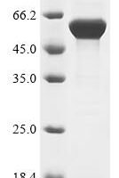 Ophiophagus hannah L-amino-acid oxidase Recombinant Protein - BioCrest Sci