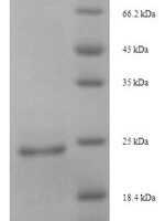 Naja atra Cytotoxin 4 Recombinant Protein - BioCrest Sci
