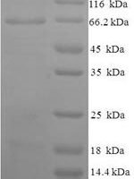 Human Atrial natriuretic peptide receptor 1 (NPR1), partial Recombinant Protein, N-His-SUMO - BioCrest Sci