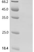 Human Dynamin-1 (DNM1) Recombinant Protein - BioCrest Sci