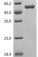 Human Glutathione S-transferase kappa 1 (GSTK1), partial Recombinant Protein - BioCrest Sci