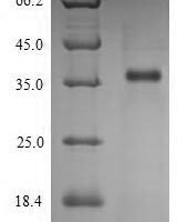 Human L-lactate dehydrogenase C chain (LDHC), partial Recombinant Protein, N-His - BioCrest Sci