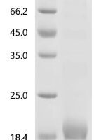 Mouse Metallothionein-1 (Mt1) Recombinant Protein - BioCrest Sci