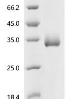 Severe acute respiratory syndrome coronavirus 2 Spike glycoprotein (S), partial (E484K,N501Y) Recombinant Protein, C-10His - BioCrest Sci