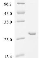 Human Rhombotin-2 (LMO2) Recombinant Protein - BioCrest Sci