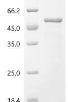 Ambrosia artemisiifolia Pectate lyase 5 Recombinant Protein, C-His - BioCrest Sci