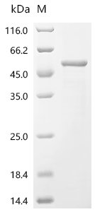 Ambrosia artemisiifolia Pectate lyase 5 Recombinant Protein, C-His, Ambrosia artemisiifolia (Short ragweed), E.coli, C-terminal 6xHis-tagged, 46.8 kDa, purity >≥ 85% as determined by SDS-PAGE.