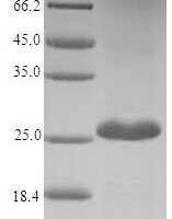 Dendroaspis angusticeps Fasciculin-2 (Fas-2) Recombinant Protein - BioCrest Sci