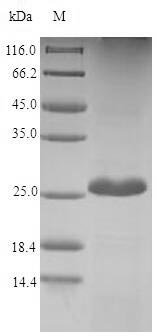 Dendroaspis angusticeps Fasciculin-2 (Fas-2) Recombinant Protein, Dendroaspis angusticeps (Eastern green mamba) (Naja angusticeps), E.coli, N-terminal 6xHis-SUMO-tagged, 22.8 kDa, purity >≥ 90% as determined by SDS-PAGE.