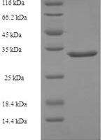 Human Growth arrest and DNA damage-inducible protein GADD45 gamma (GADD45G) Recombinant Protein - BioCrest Sci
