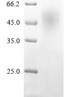 Mouse Complement C1q tumor necrosis factor-related protein 6 (C1qtnf6) Recombinant Protein, N-His-SUMOstar - BioCrest Sci
