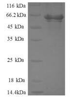 Human Activator of 90 kDa heat shock protein ATPase homolog 1 (AHSA1) Recombinant Protein - BioCrest Sci