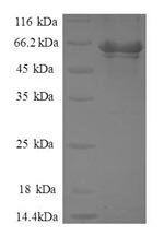 Human Activator of 90 kDa heat shock protein ATPase homolog 1 (AHSA1) Recombinant Protein, Homo sapiens (Human), E.coli, N-terminal GST-tagged, 65.3 kDa, purity >≥ 90% as determined by SDS-PAGE.