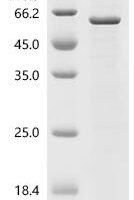 Pseudoalteromonas carrageenovora Kappa-carrageenase (cgkA) Recombinant Protein - BioCrest Sci