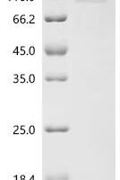 Seoul virus Envelopment polyprotein (GP), partial Recombinant Protein - BioCrest Sci