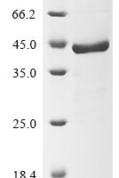Human Fructose-bisphosphate aldolase C (ALDOC) Recombinant Protein - BioCrest Sci