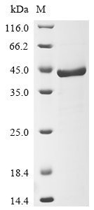Human Fructose-bisphosphate aldolase C (ALDOC) Recombinant Protein, Homo sapiens (Human), E.coli, N-terminal 6xHis-tagged, 43.5 kDa, purity >≥ 85% as determined by SDS-PAGE.