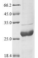 Human Trifunctional purine biosynthetic protein adenosine-3 (GART), partial Recombinant Protein - BioCrest Sci