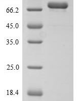 Human Mucosal addressin cell adhesion molecule 1 (MADCAM1), partial Recombinant Protein, C-His - BioCrest Sci