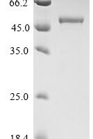 Bat coronavirus 133/2005 Nucleoprotein (N) Recombinant Protein, N-His - BioCrest Sci