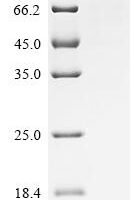 Mouse Transferrin receptor protein 2 (Tfr2), partial Recombinant Protein - BioCrest Sci