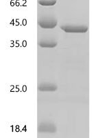 Human Cyclin-dependent kinase 12 (CDK12), partial Recombinant Protein, N-10His/C-Myc - BioCrest Sci